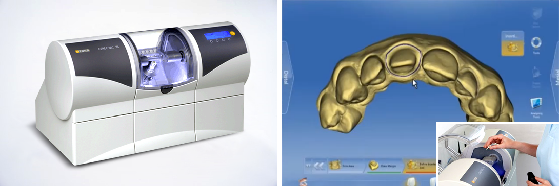 독일 명품 장비 세렉