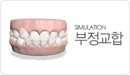 부정교합