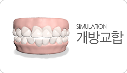 개방교합