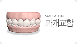 과개교합