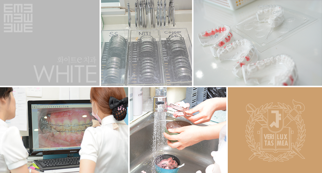화이트e치과 치아교정