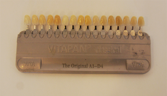 치아교정 보증제도