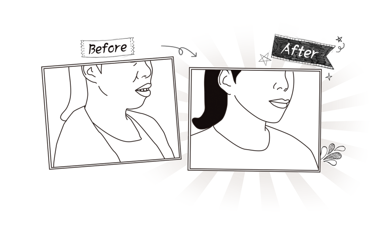 치아 교정치료 종료