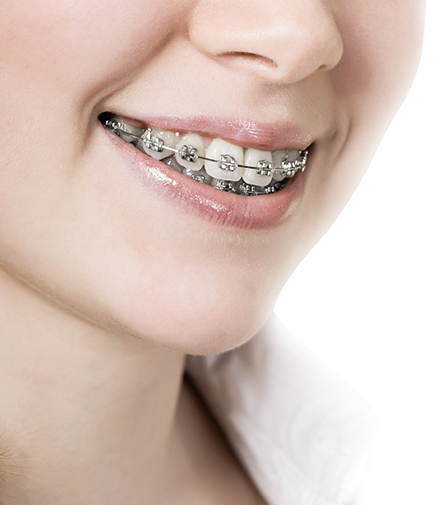 화이트e치과 교정치료 과정