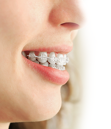 화이트e치과 교정치료 과정