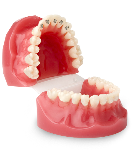 화이트E치과 교정치료 과정