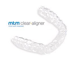 킄리어얼라이너