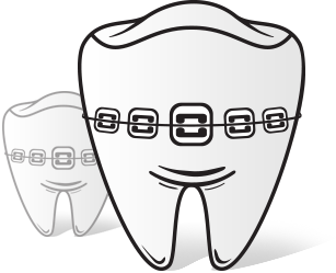 기간을 단축시킨 돌출입 해결 치아교정!