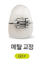 메탈교정