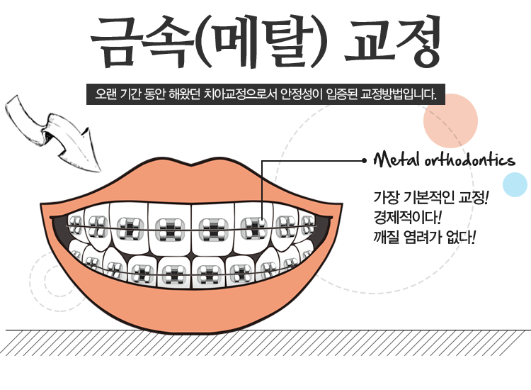 금속(메탈)교정