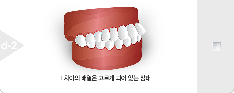 치아의 배열은 고르게 되어 있는 상태
