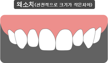 여러분께 과장된 치료를 권하지 않는 화이트e치과 입니다!