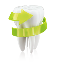 라미네이트가 좋은 이유