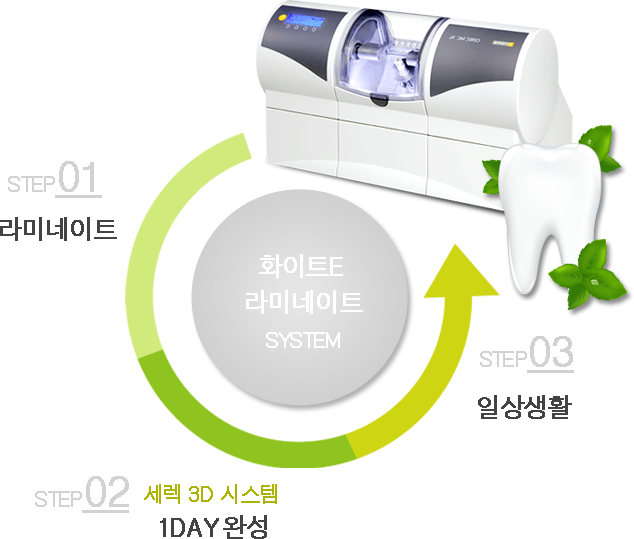 화이트E 라미네이트 시스템