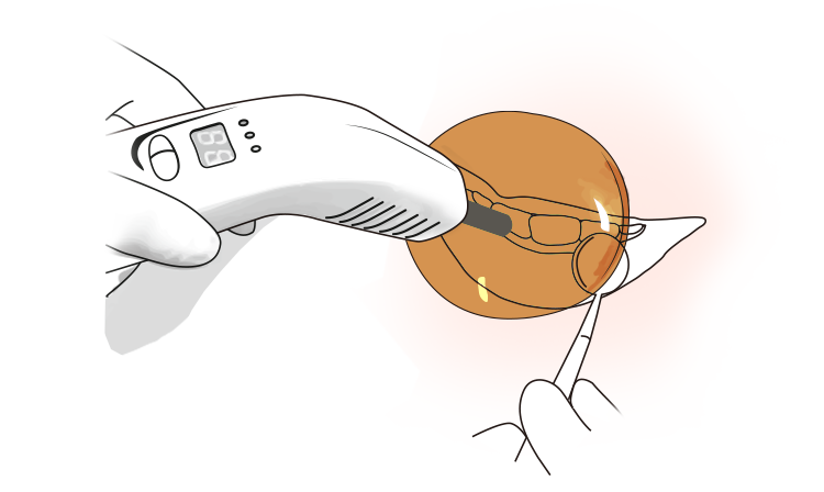 레진 단단하게 굳히기