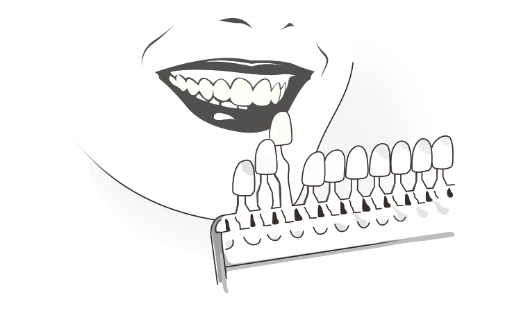 레진 색상 선택