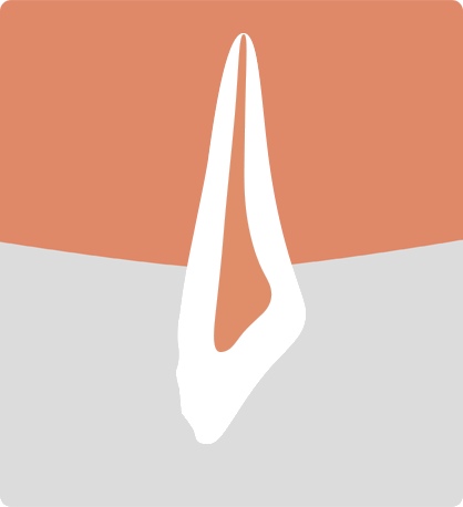 라미네이트 애니메이션