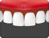 멜라닌 색소 침착으로 인해 잇몸의 색상이 검은 경우