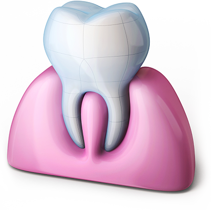 잇몸성형 시술과정