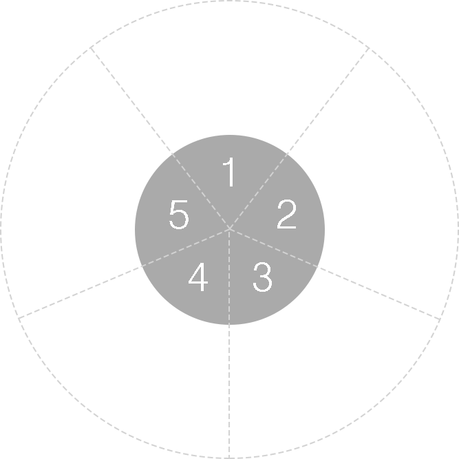 전악(무치악) 임플란트 치료과정