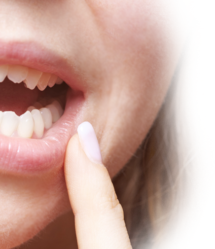 어금니 임플란트 치료과정