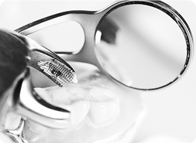 손상된 치아 발치