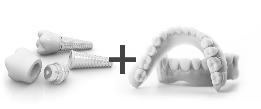 임플란트 틀니