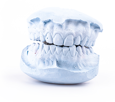 임플란트 틀니 이런 분들에게 필요해요