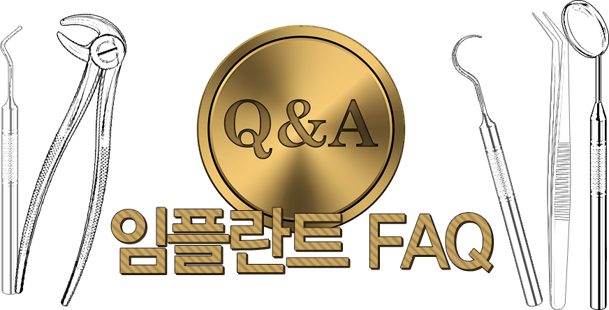 임플란트 faq