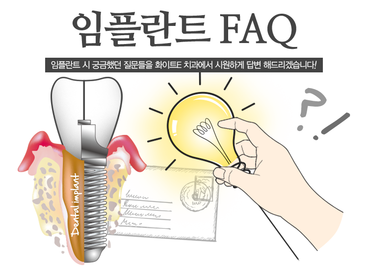 임플란트 FAQ