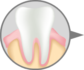 건강한 치주조직