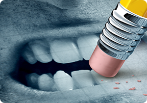 스케일링을 하면 치아가 삭제되나요?