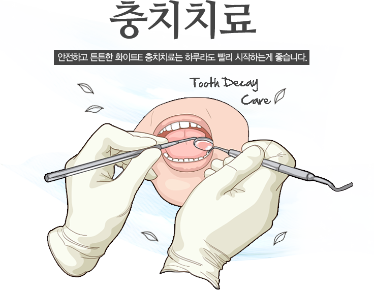 충치치료